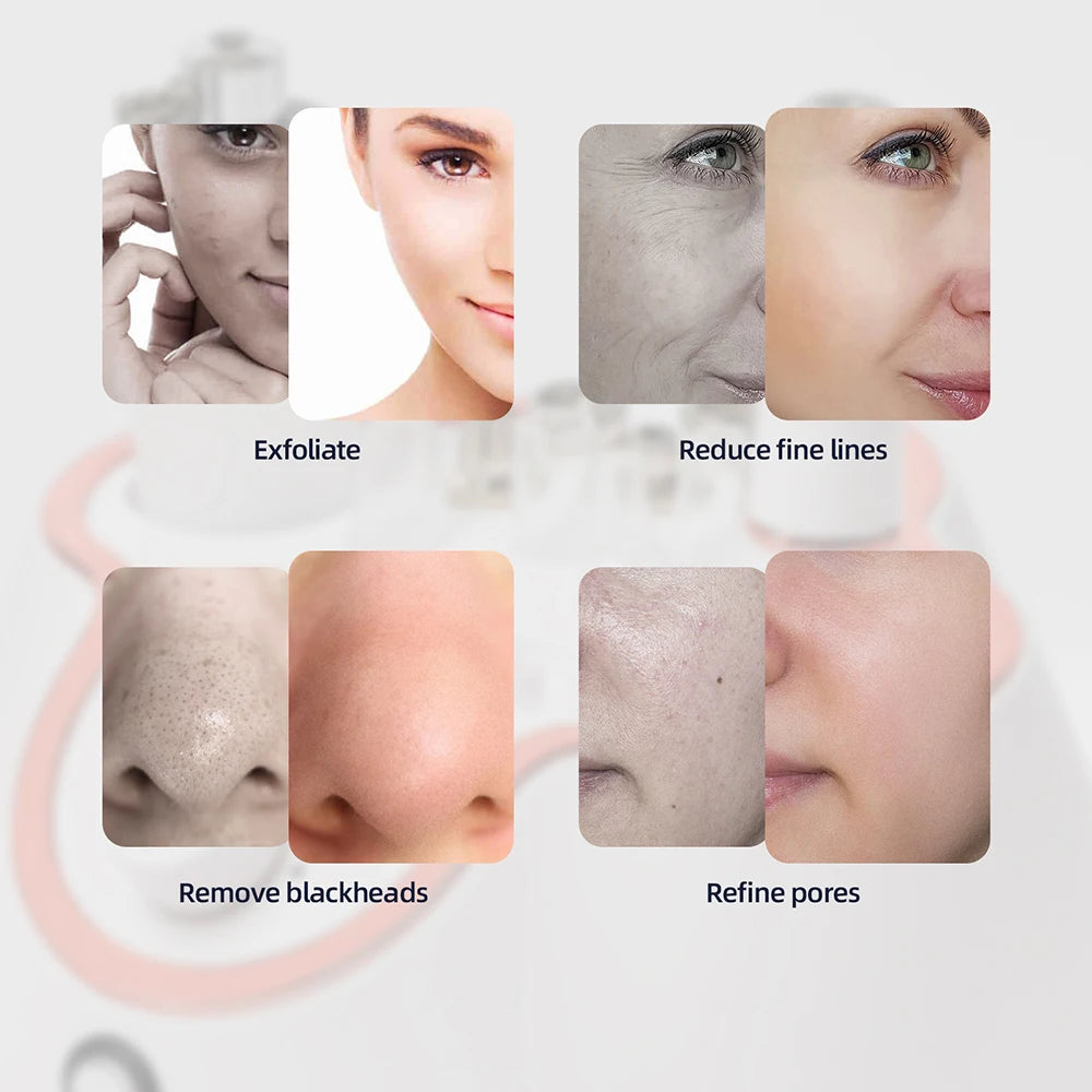 SkinAura™ 3-in-1 Diamond Facial Rejuvenation System